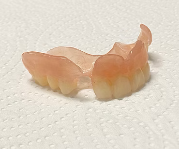 Flexible Prothese Oberkiefer