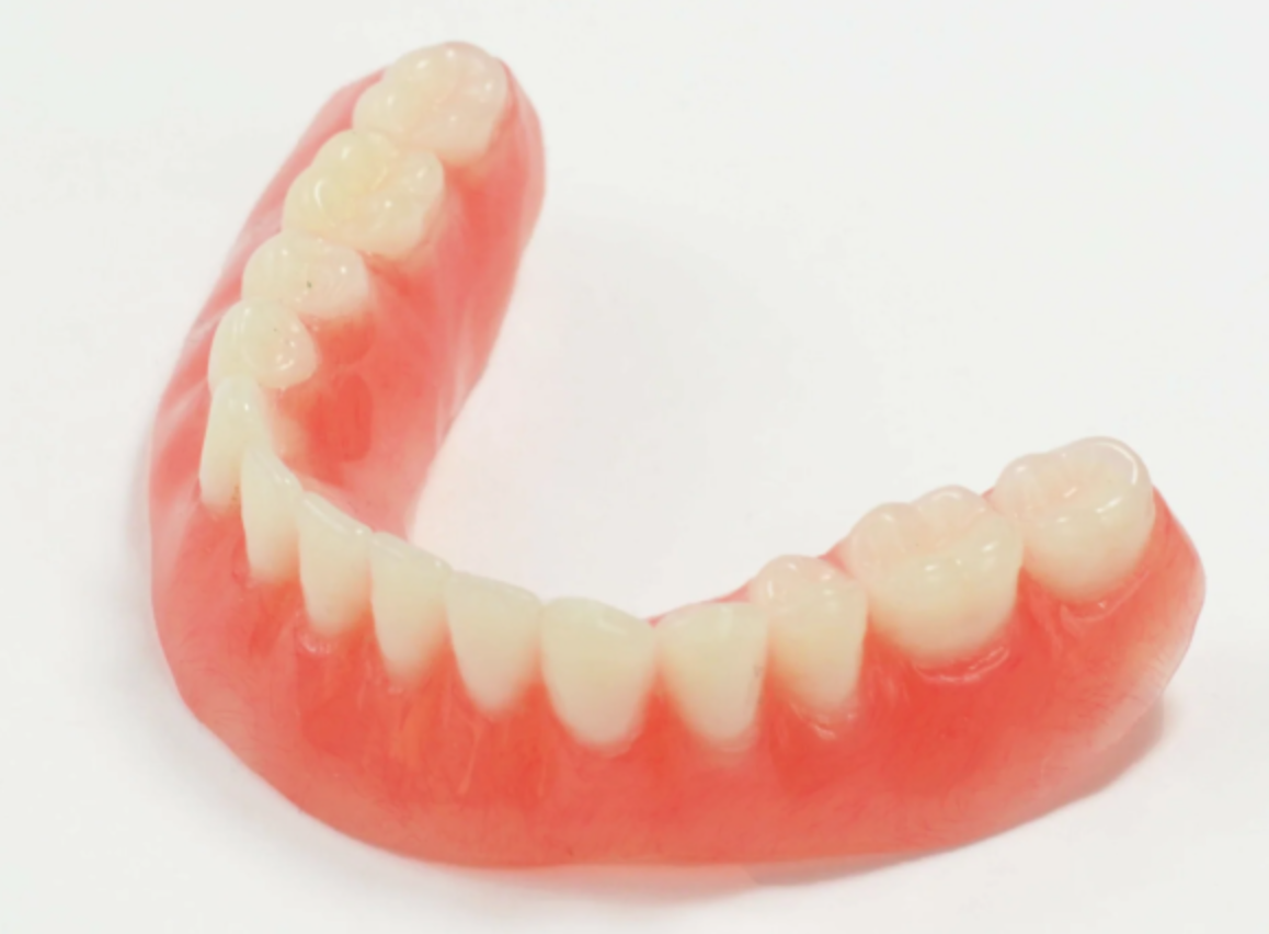 Vollprothese Unterkiefer