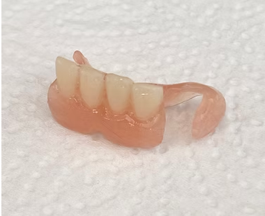 Flexible Prothese Unterkiefer