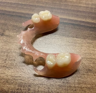 Flexible Prothese Unterkiefer