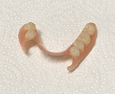 Flexible Prothese Unterkiefer